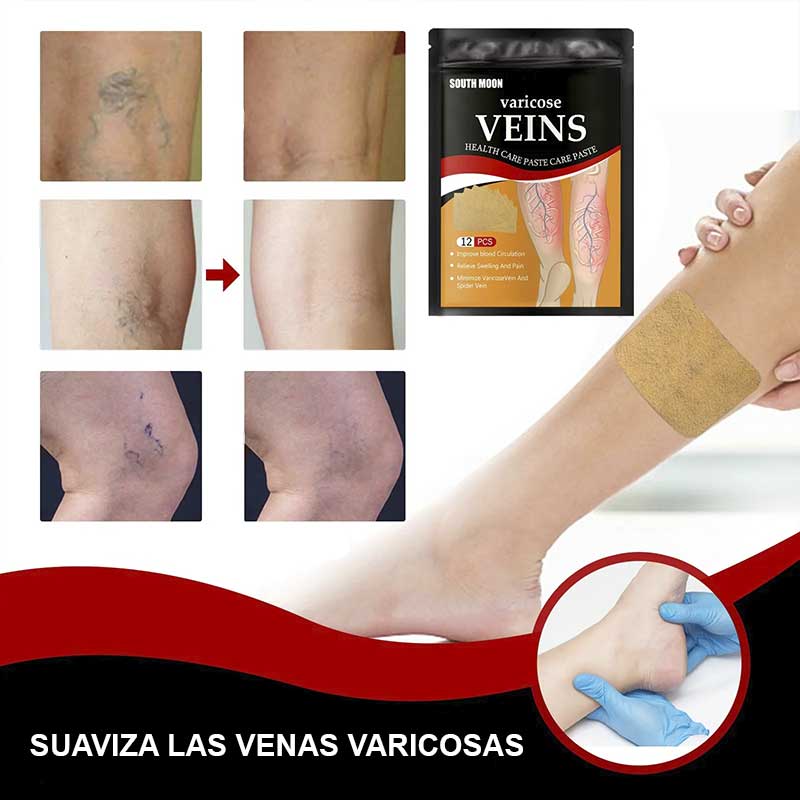 🌟 Parches Antivárices 2x1 - ¡Piernas ligeras y sin dolor! 🌟