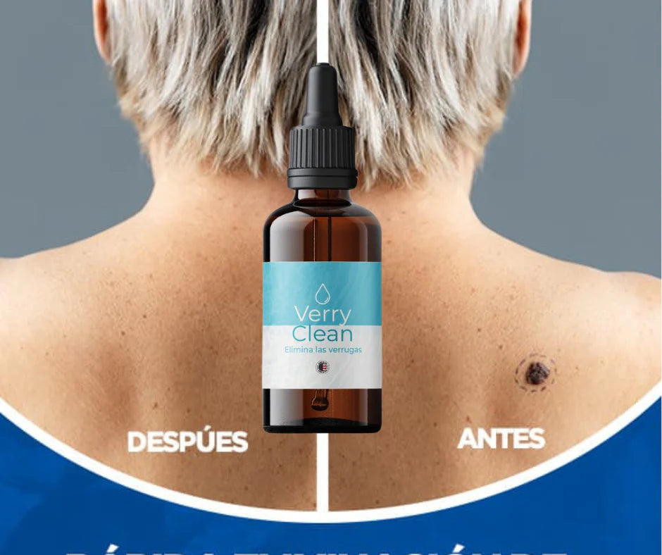 🍃Verryclean 🤩 Elimina verrugas para siempre😱