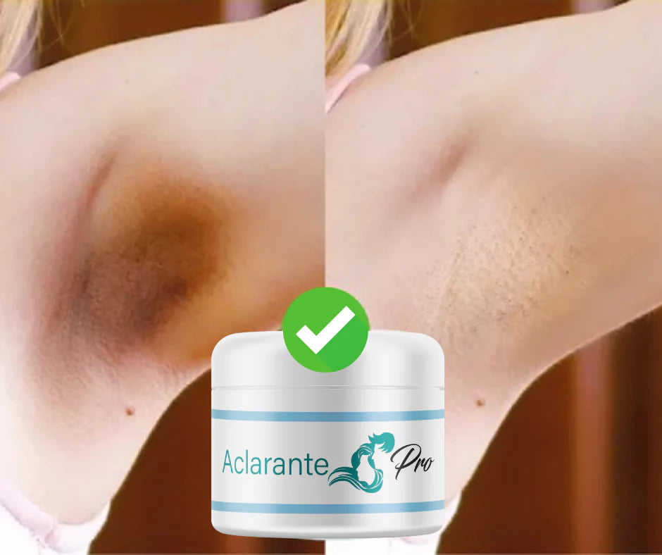Crema Aclarante Despídete de las manchas incómodas ✨🌙